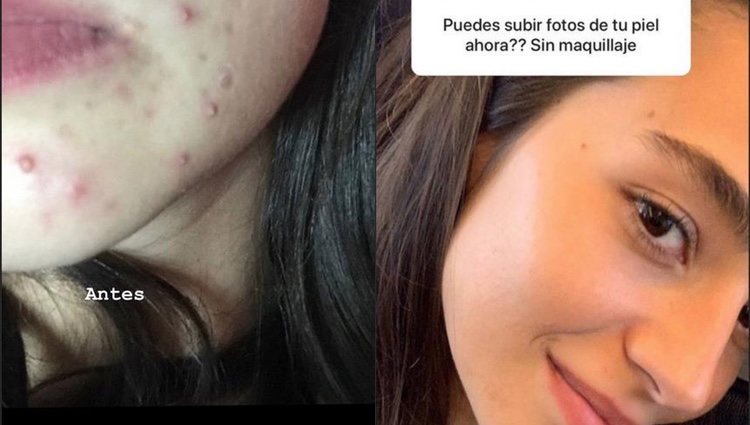 El antes y el después del rostro de Rocío Crusset/ Foto: Instagram