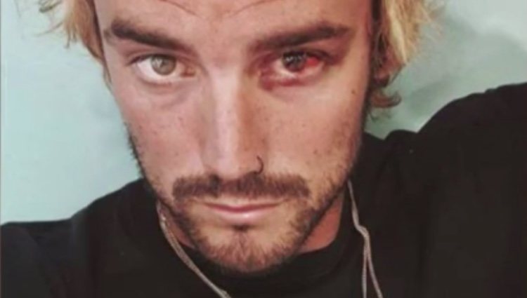 Logan sube una foto de su ojo a las stories de Instagram / Foto: Instagram
