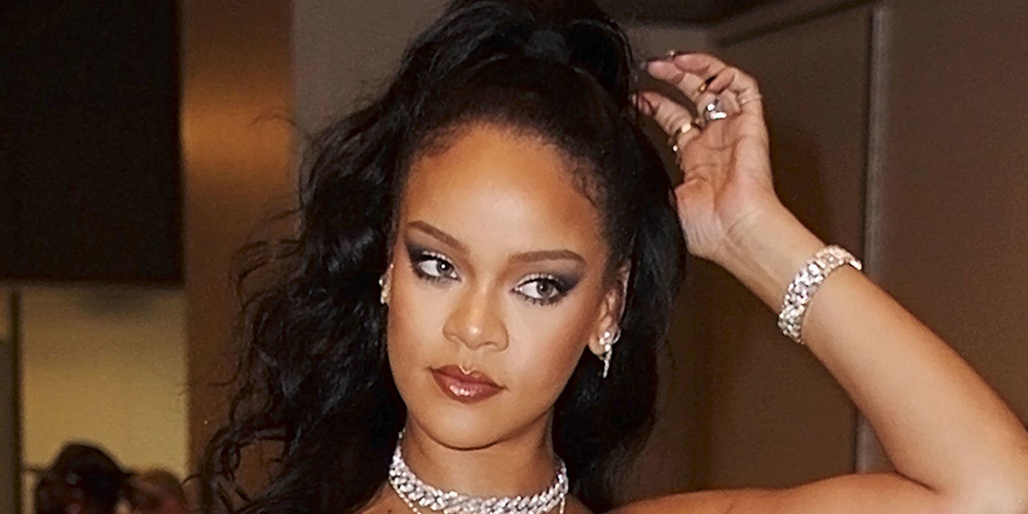 Rihanna sufre un aparatoso accidente de moto y acaba con la cara llena de heridas