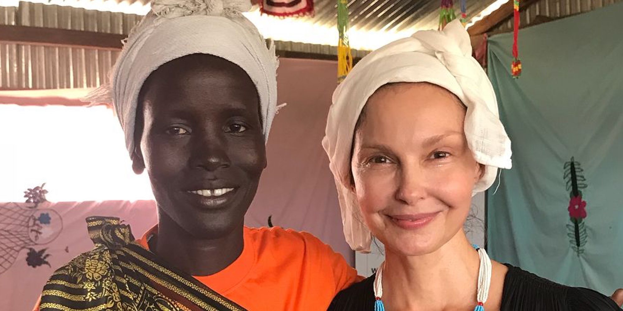 Ashley Judd enseña las imágenes de su traslado cuando casi pierde la pierna en el Congo
