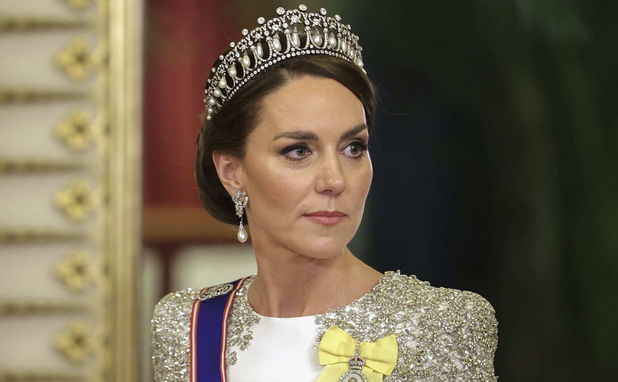 El Palacio de Kensington confirma que la operación de Kate Middleton no tiene que ver con un problema canceroso