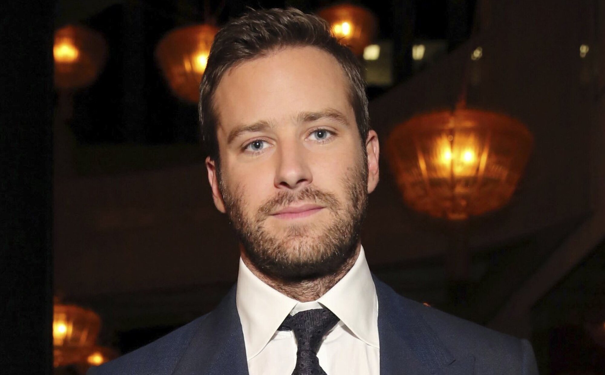 Armie Hammer ve el lado positivo a su 'cancelación': "Estoy arruinado, pero soy más feliz que nunca"