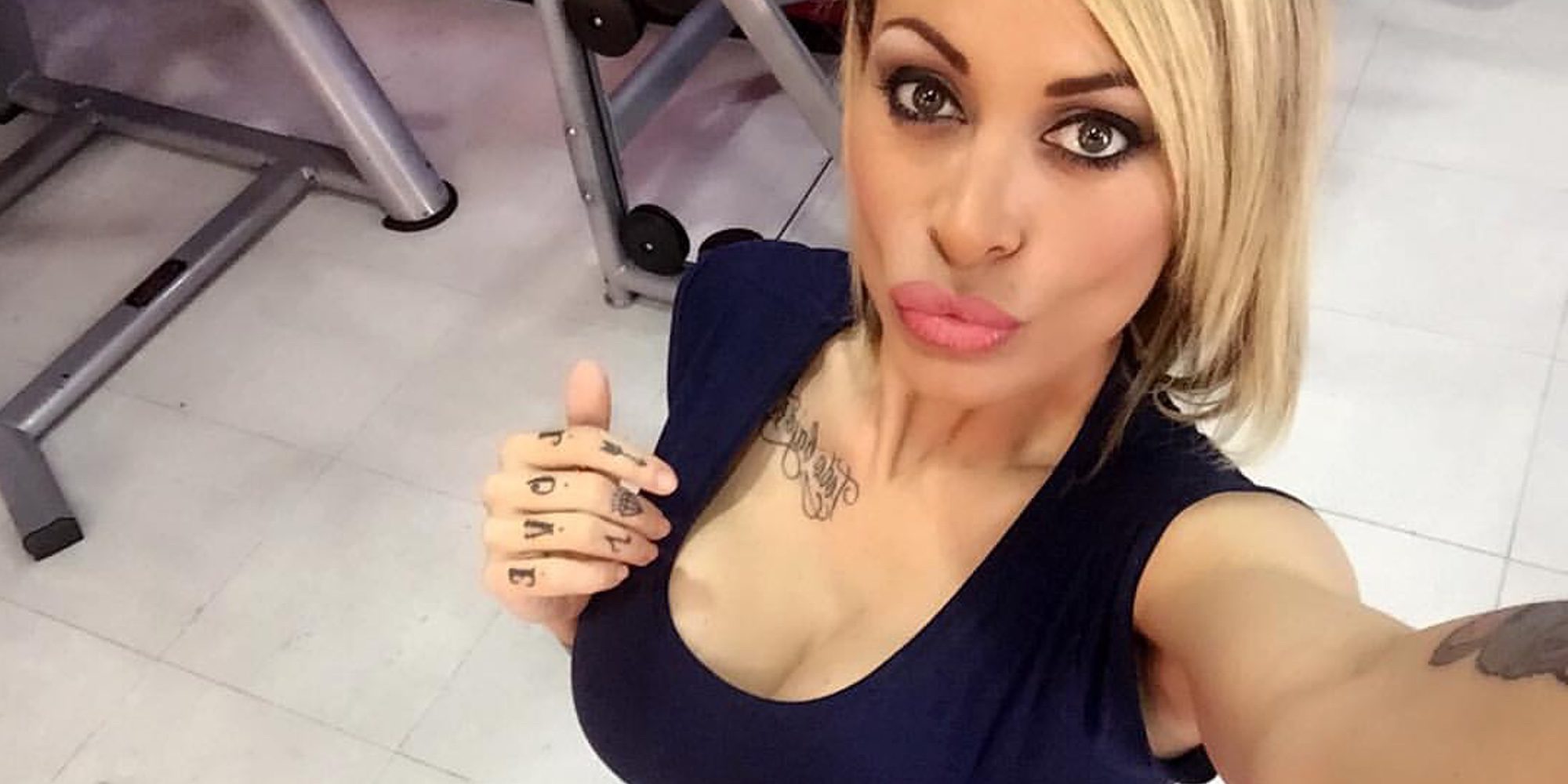 Tatiana Delgado sufre una dolorosa infección en el culo por una operación estética mal hecha