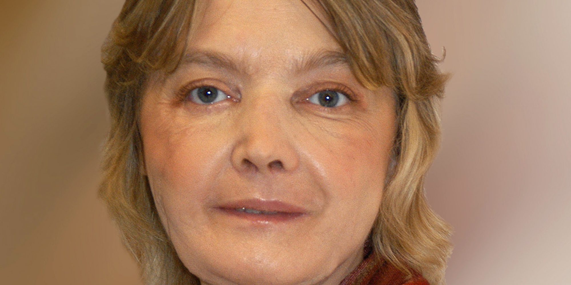 Muere Isabelle Dinoire, la mujer francesa que se sometió al primer trasplante de cara
