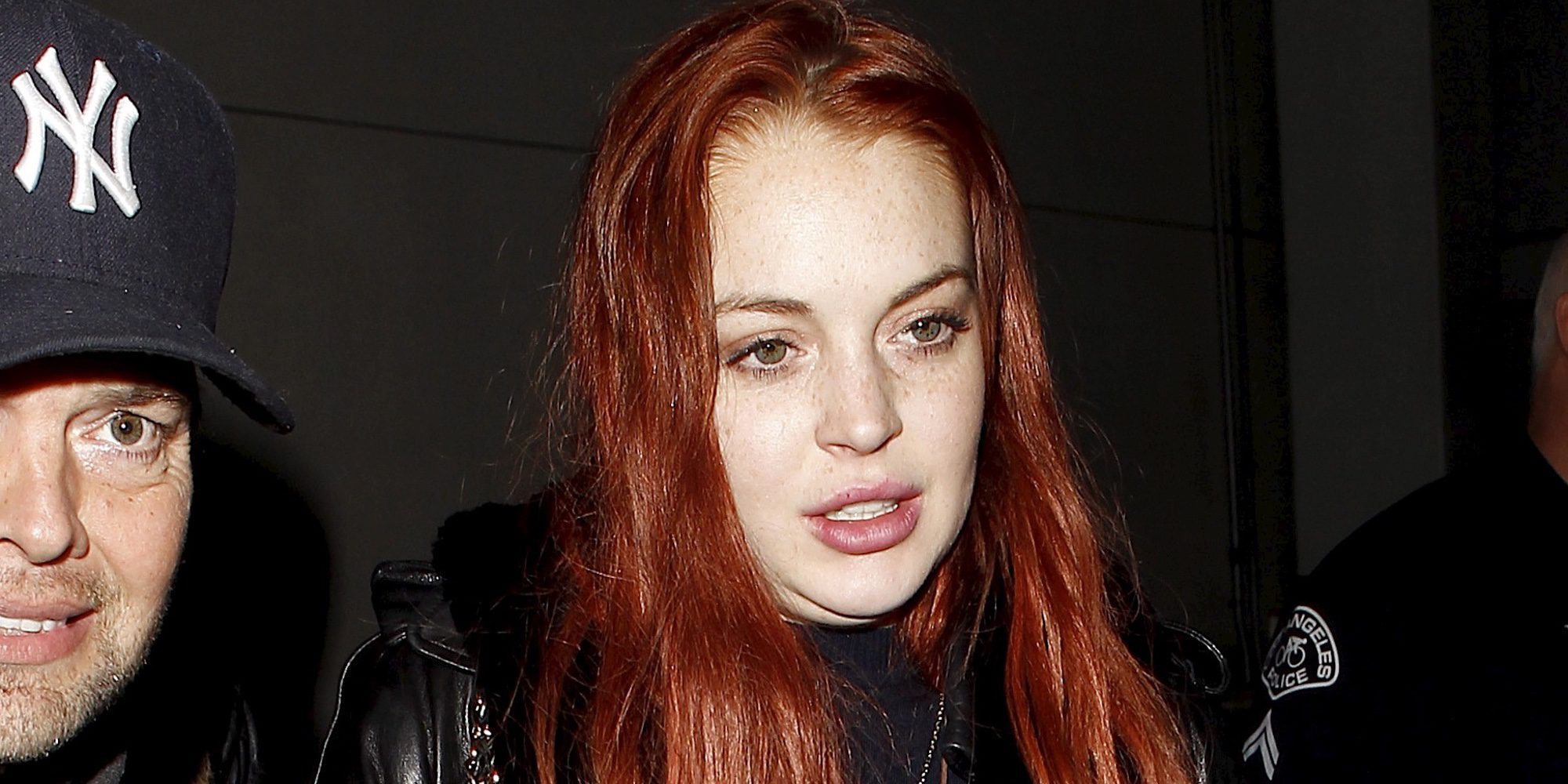 Lindsay Lohan, operada de urgencia tras perder la mitad de un dedo en Turquía