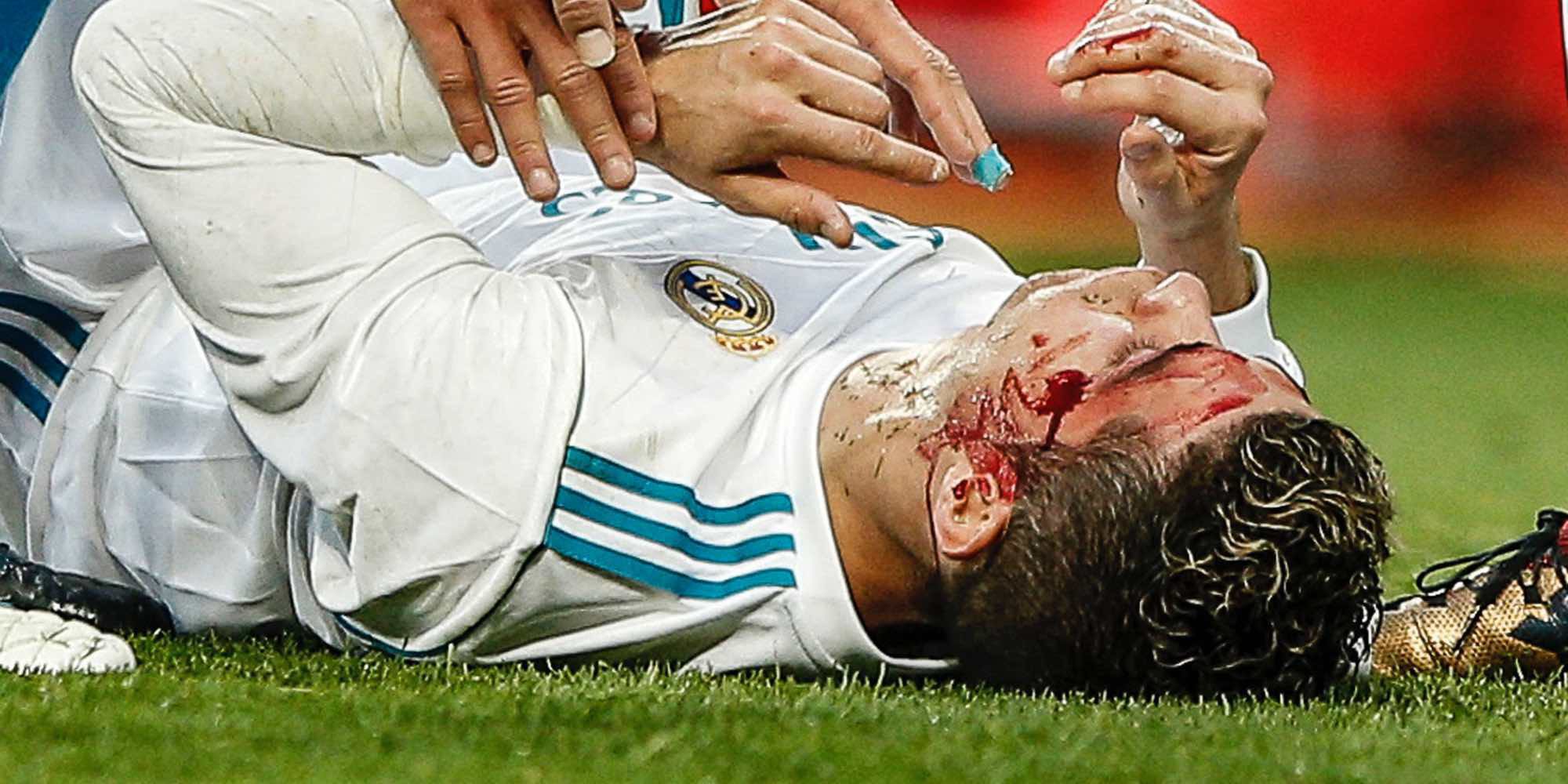 El susto de Georgina Rodríguez al ver a Cristiano Ronaldo con la cara ensangrentada