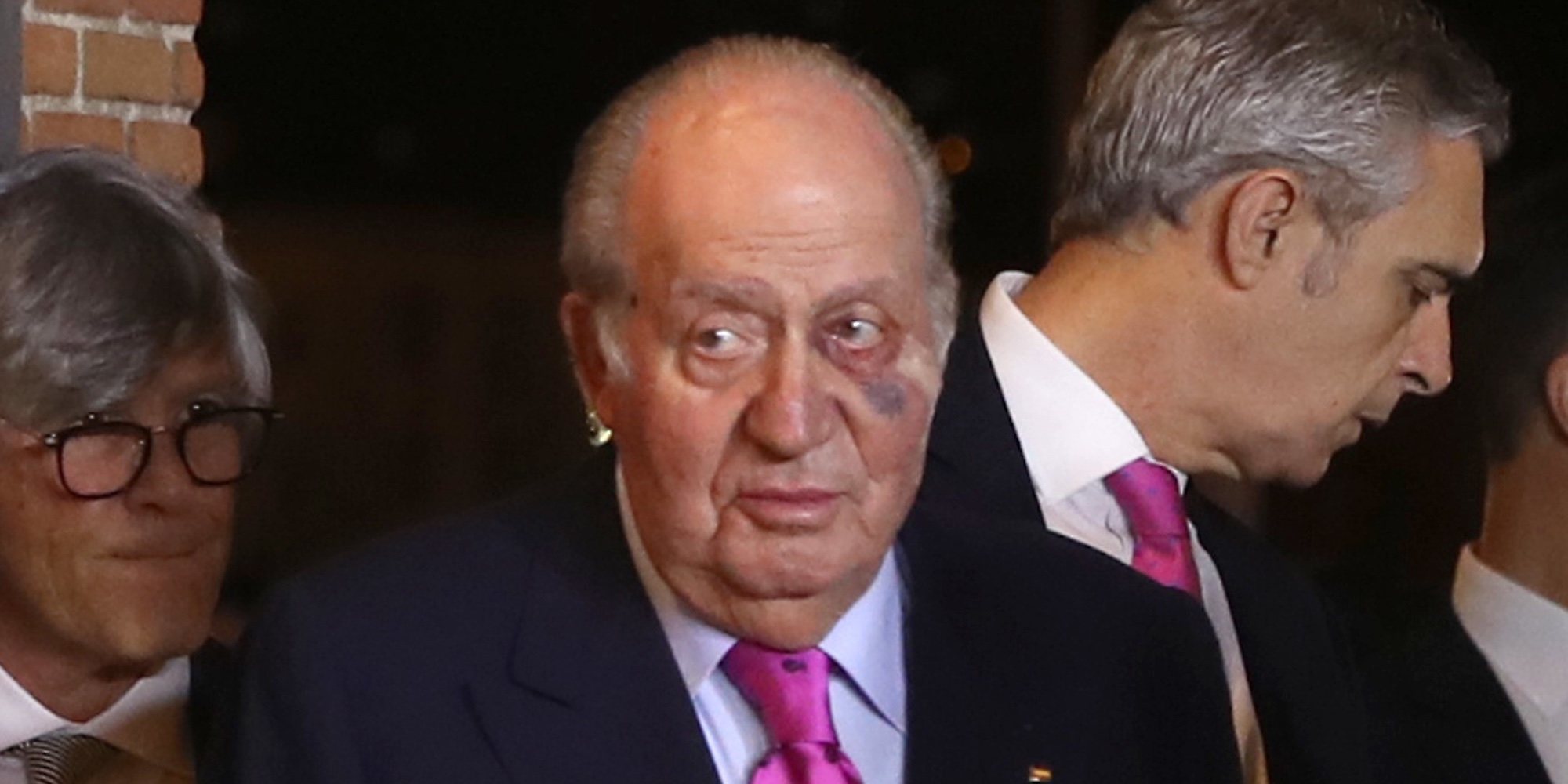 Los asiduos viajes privados del Rey Juan Carlos a Estados Unidos se suman a un hematoma sospechoso en el ojo