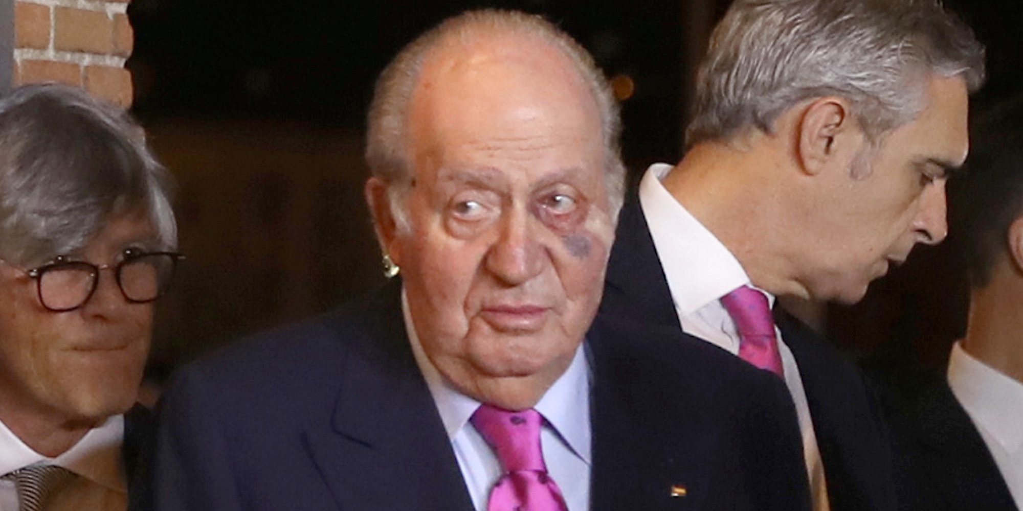 El Rey Juan Carlos, operado de un carcinoma basocelular