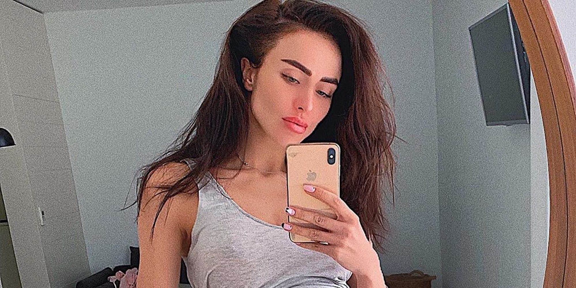 Muere la modelo Janna Rasskazova a los 29 años tras inyectarse vitaminas para combatir la resaca