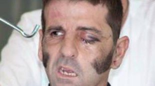 Juan José Padilla recibe el alta hospitalaria tras su gravísima cogida en la cara