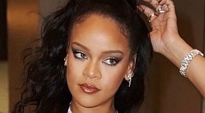 Rihanna sufre un aparatoso accidente de moto y acaba con la cara llena de heridas