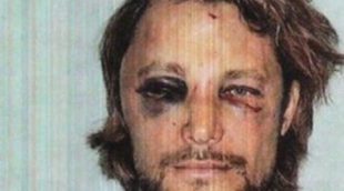 Gabriel Aubry, supuestamente amenazado de muerte por Olivier Martínez,  muestra cómo quedó su rostro tras la brutal pelea