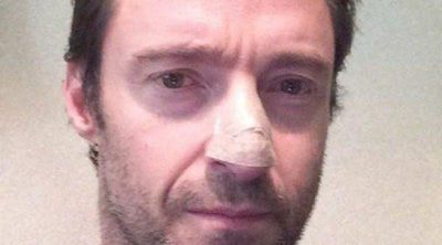 Hugh Jackman desvela que sufre cáncer de piel en la nariz