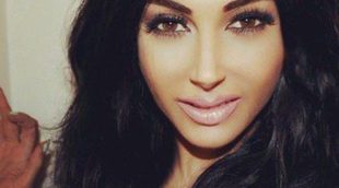 Una joven gasta 30.000 dólares en cirugía para parecerse a Kim Kardashian
