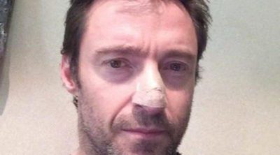 Hugh Jackman, operado por quinta vez a causa de un cáncer de piel