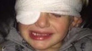Un niño británico entra en un hospital por una brecha y sale con un ojo pegado