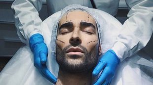 La operación de estética de Miguel para llegar a fin de mes