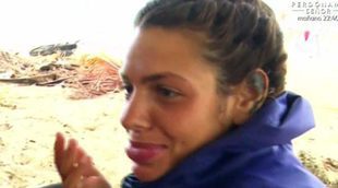 Laura Matamoros, atacada por una araña en los labios en 'Supervivientes 2017'
