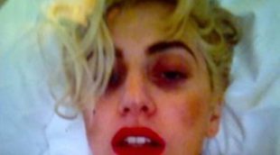 Lady Gaga publica en Twitter una foto con el ojo morado a consecuencia del accidente que sufrió en un concierto