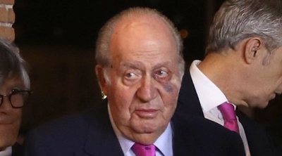 Los asiduos viajes privados del Rey Juan Carlos a Estados Unidos se suman a un hematoma sospechoso en el ojo