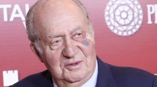 El Rey Juan Carlos, operado de un carcinoma