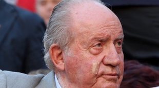 Los misteriosos apósitos del Rey Juan Carlos en la cara y el cuello