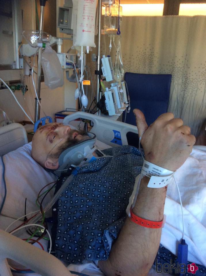 Jim Tavaré, actor de 'Harry Potter', en el hospital después de su grave accidente de coche