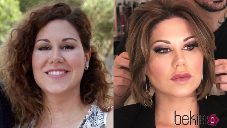 El antes y el después de la cantante Tamara