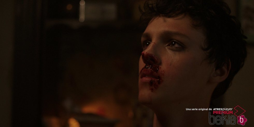 Marcos Sotkovszki sangrando en una escena de la serie 'Veneno'