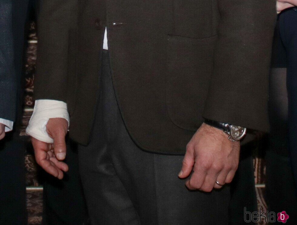 Carlos Felipe de Suecia con una escayola en la mano derecha en un acto oficial