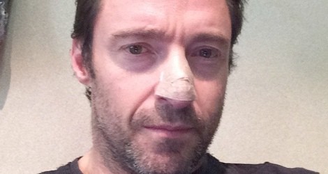 Hugh Jackman se cubre el cancer de piel