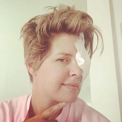 Tania Llasera con un parche en el ojo en su 37 cumpleaños